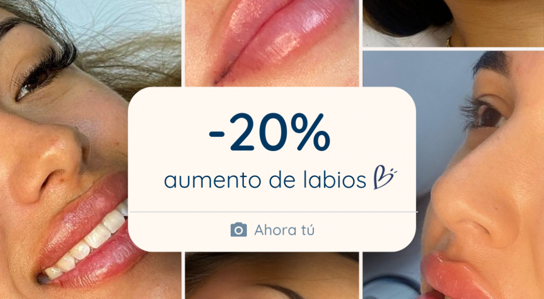 360º CLINICS: 20% EN AUMENTO DE LABIOS